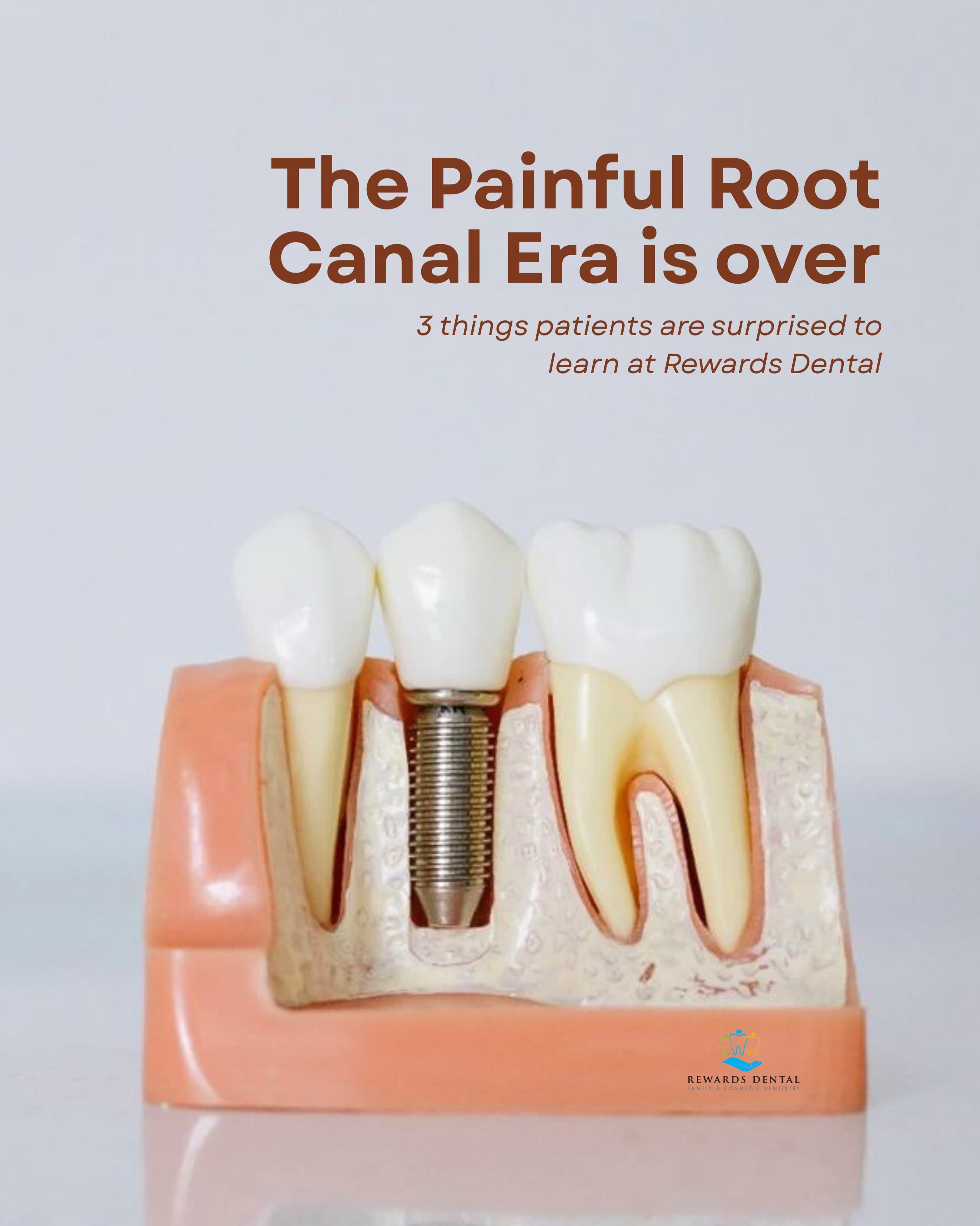 Ad creative from Rewards Dental