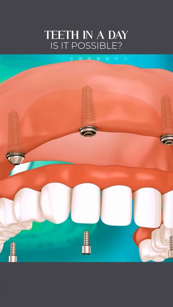 Ad creative from The Briars Dental Centre