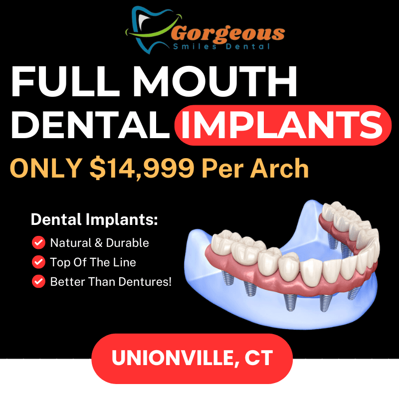 Ad creative from Gorgeous Smiles Dental