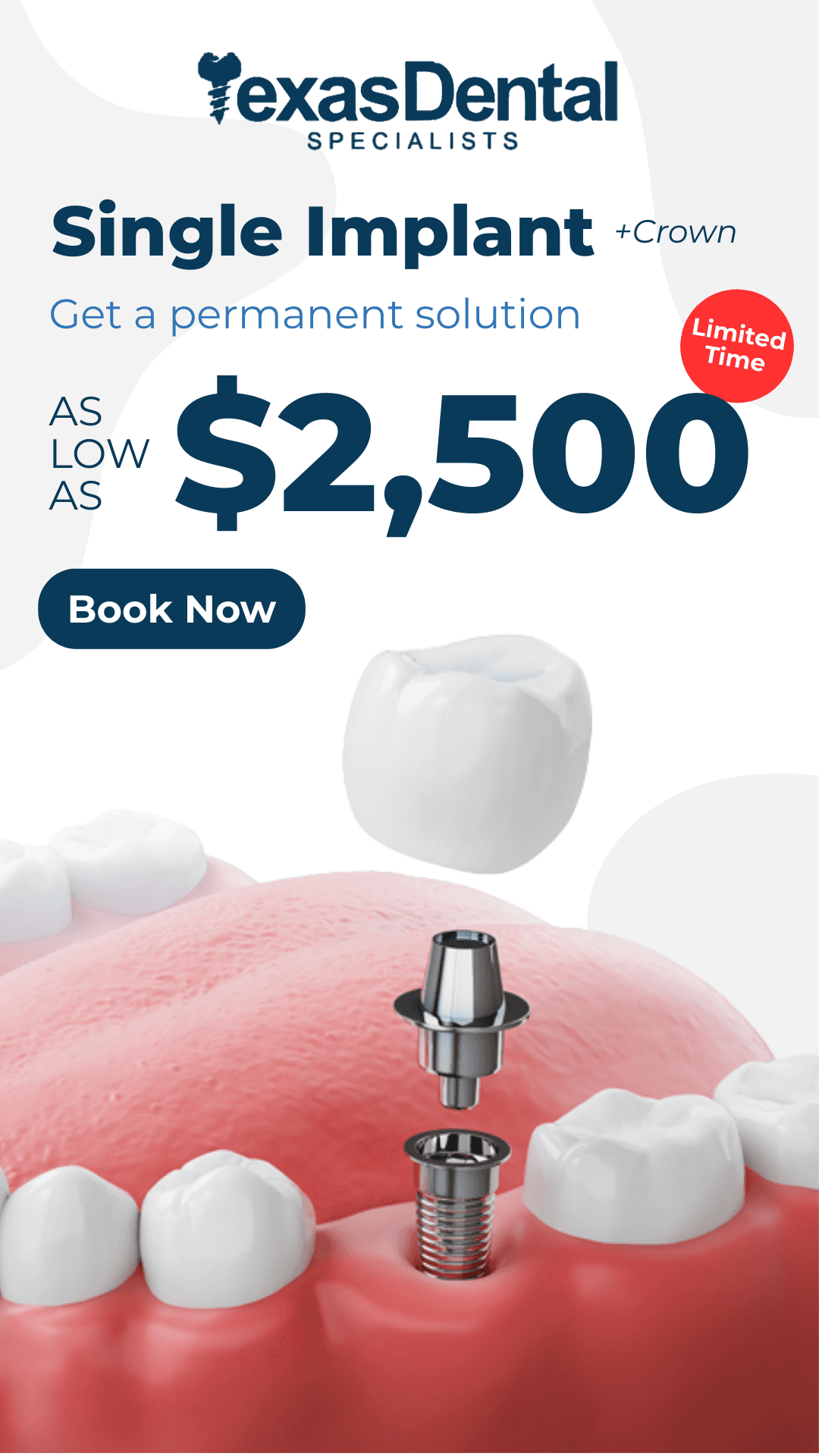 Ad creative from Texas Dental Specialists