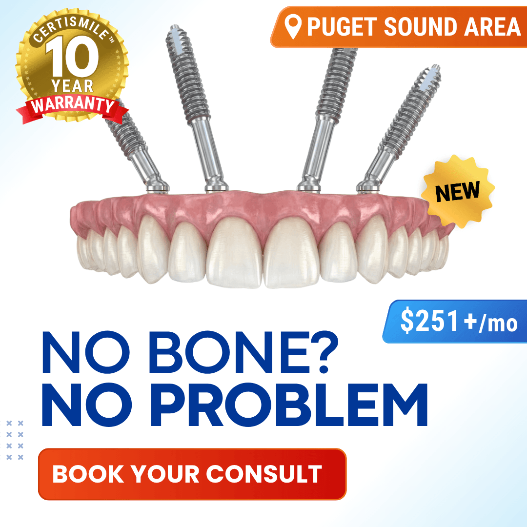 Ad creative from Smiles By Design - Rejuvenating Implant Dentistry