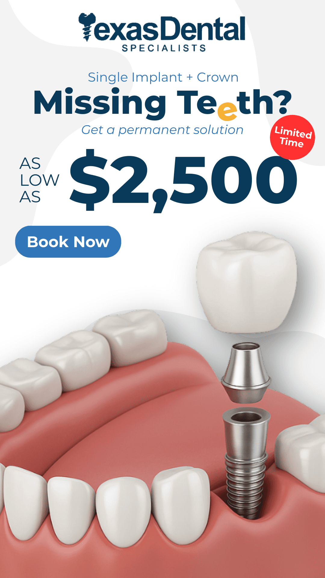 Ad creative from Texas Dental Specialists
