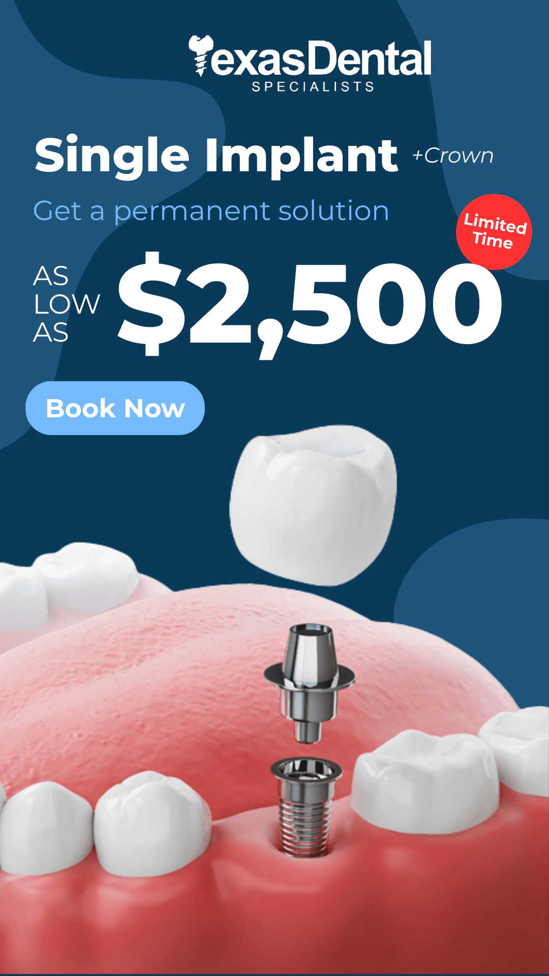 Ad creative from Texas Dental Specialists