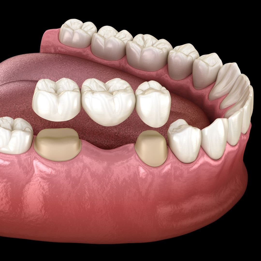 Ad creative from Dental by Design