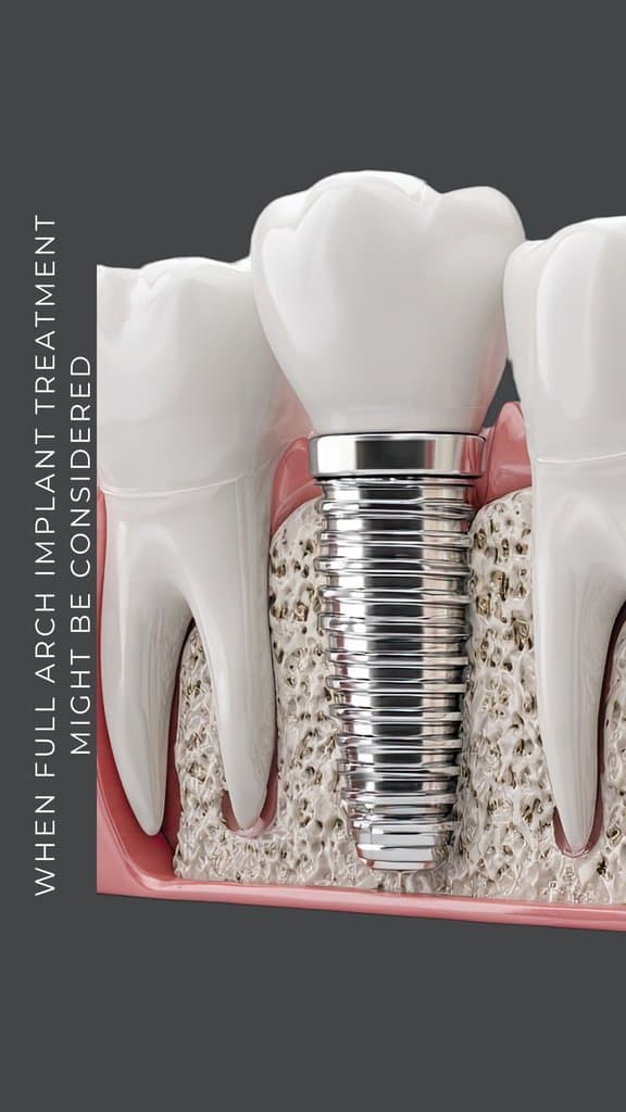 Ad creative from The Briars Dental Centre