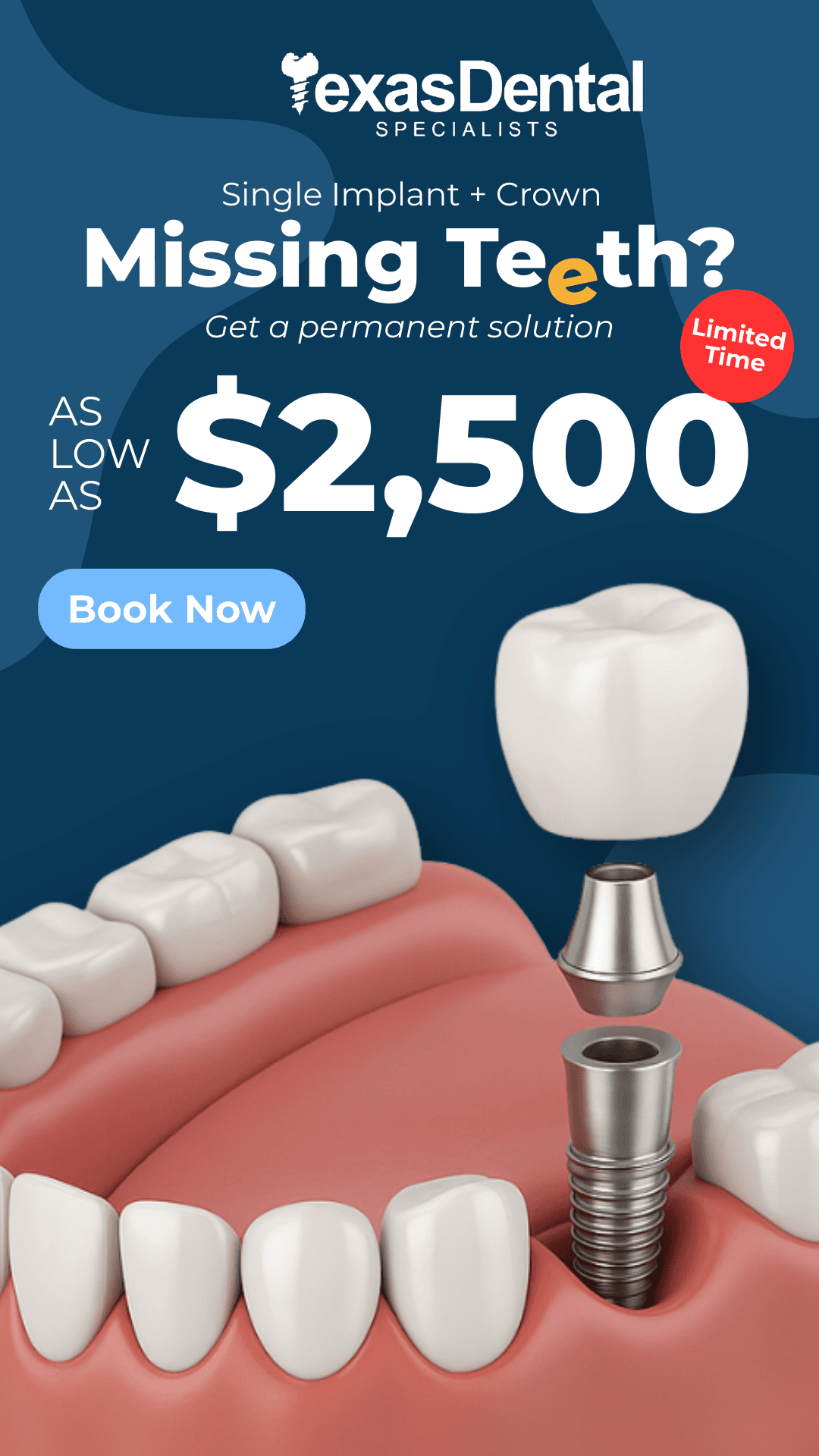 Ad creative from Texas Dental Specialists